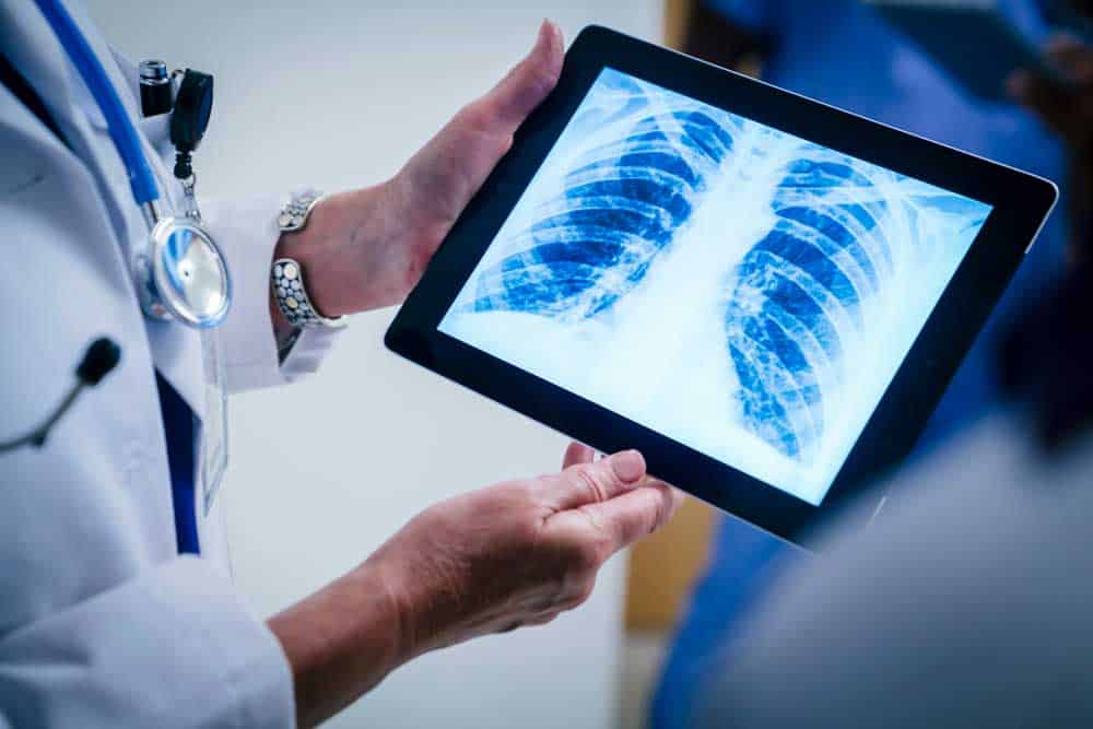 A doctor reviewing a chest X-ray on a tablet